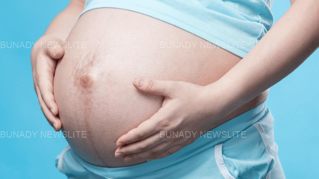 Reason Why Black Line Appear Along The Stomach Of Pregnant Women And It Functions
